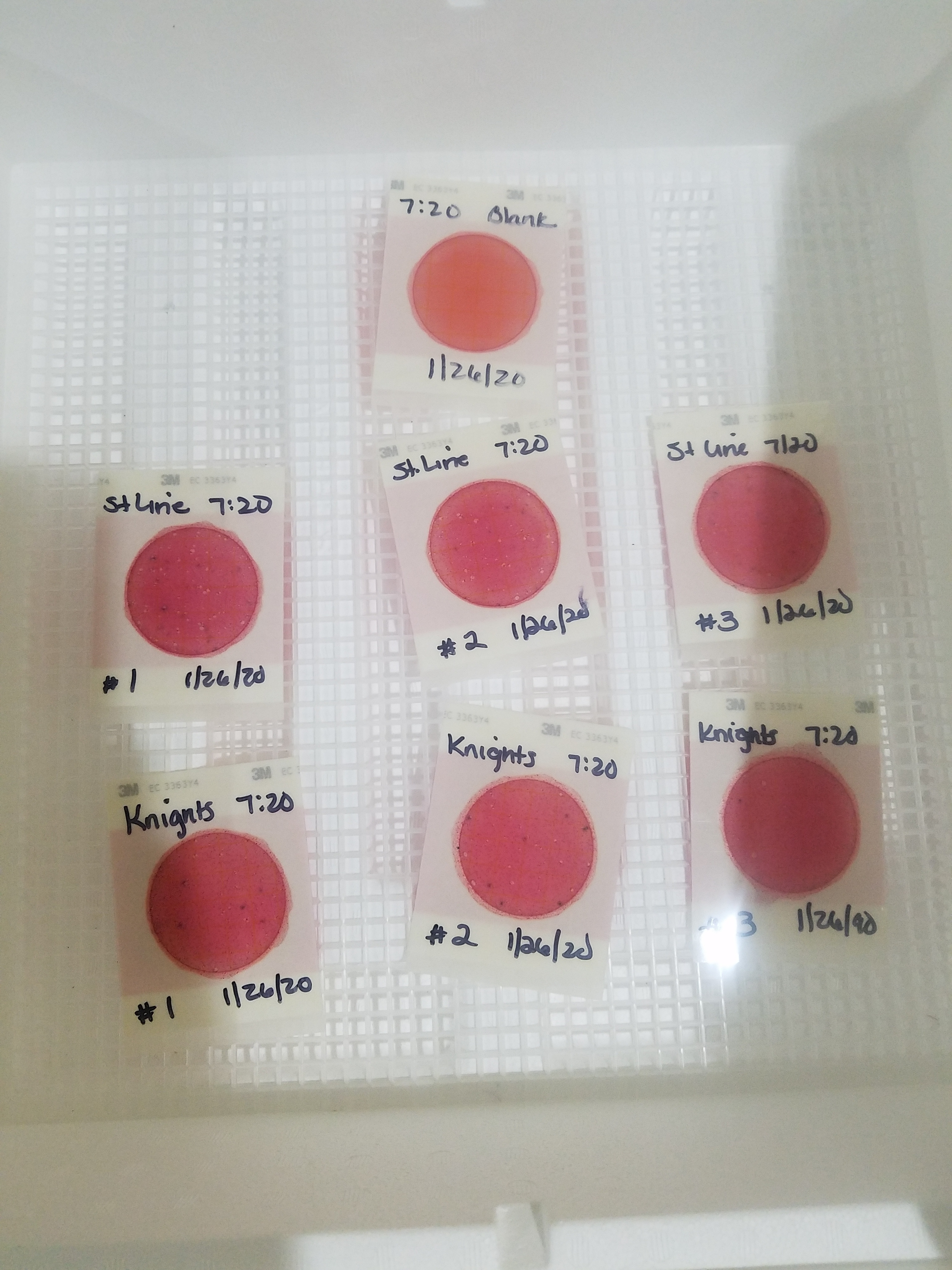 Too many E. coli colonies